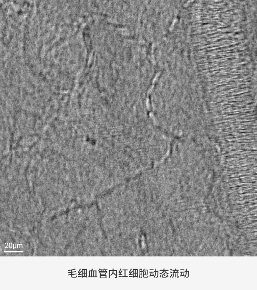 Charis-feature-3-2-CN.gif