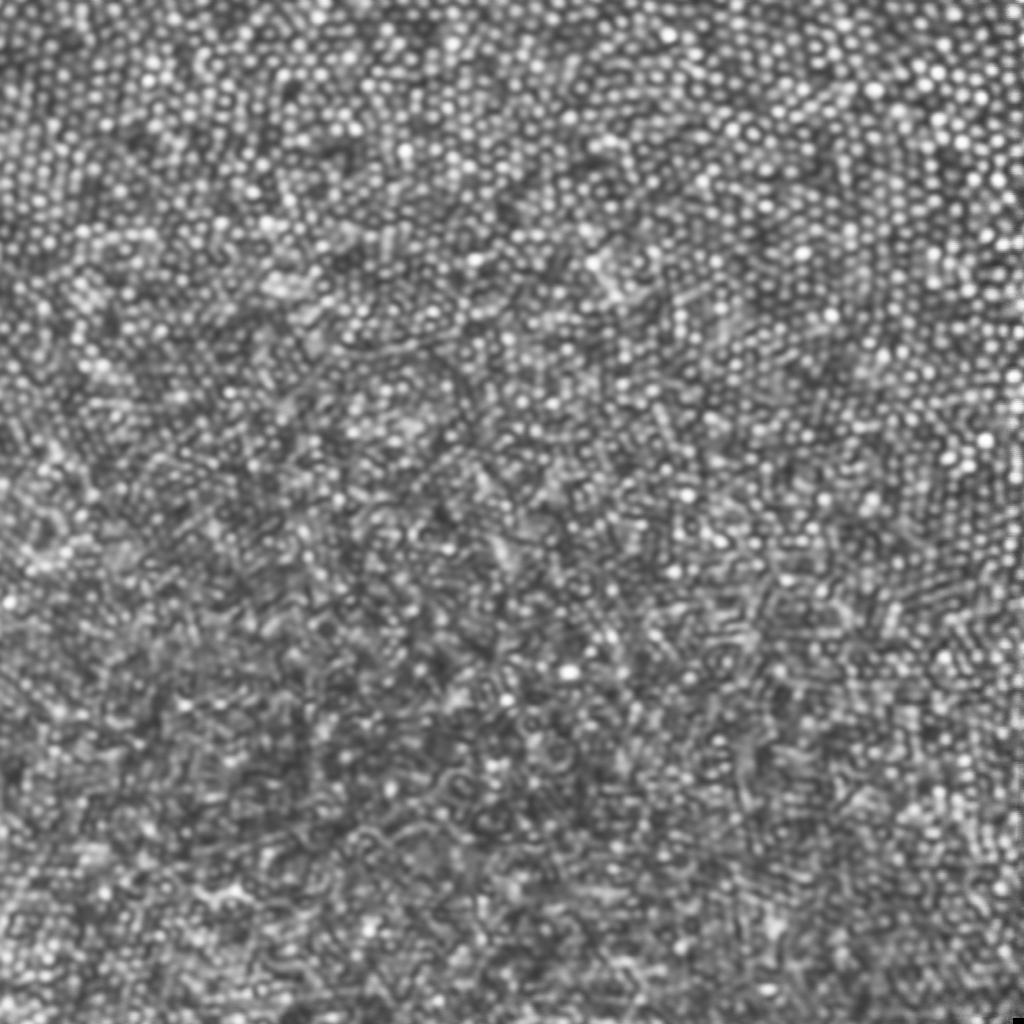 AO-SLO image of the foveal region of the living human retina, showing the cone photoreceptor mosaic.