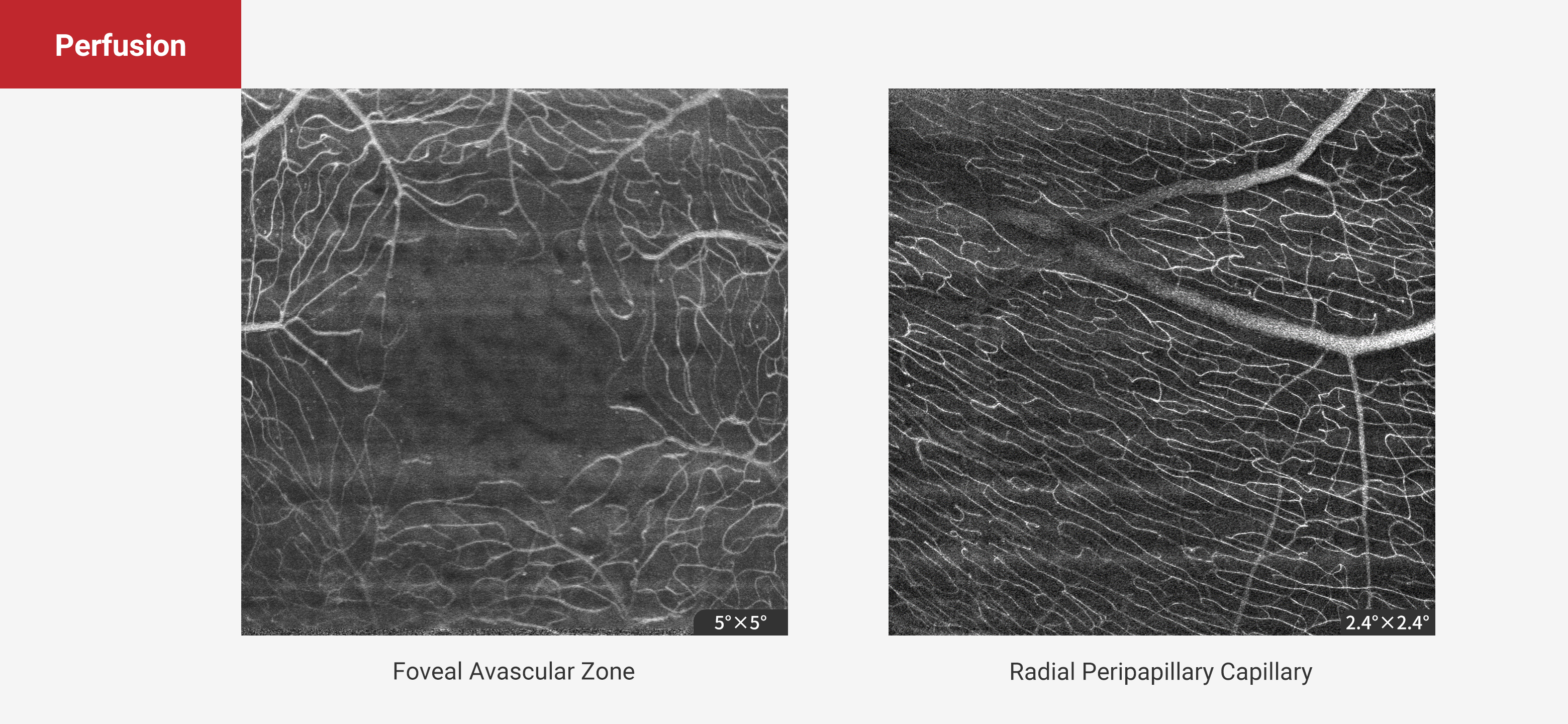 Perfusion