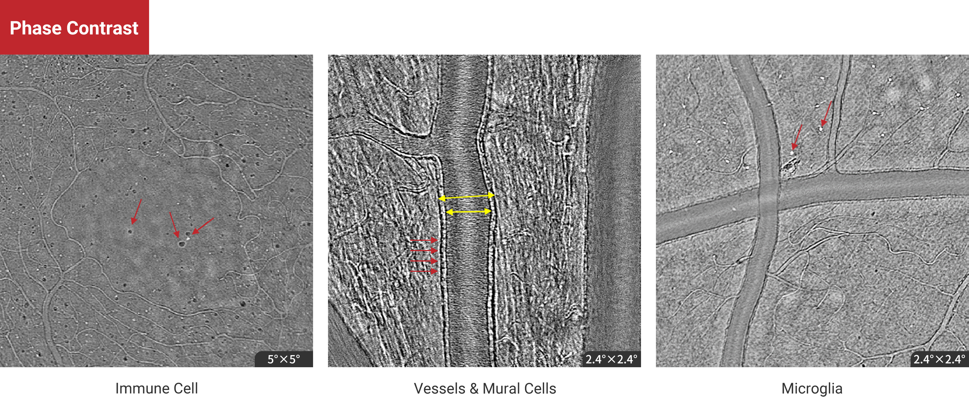 Phase Contrast